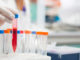 dna methylation research epigenetics growing field