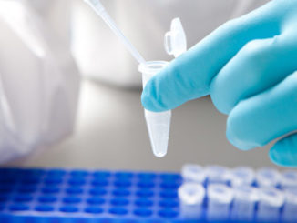 messenger RNA mRNA methylation epigenetic new technique Epigentek