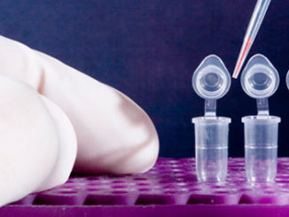 histone extraction protocol