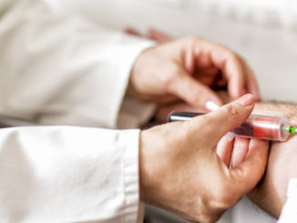 dna methylation blood signature predicts breast cancer risk epigenetics