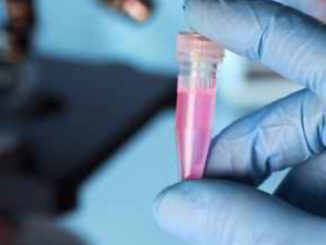 Pre-Sure ChIP Antibody Validation Kit