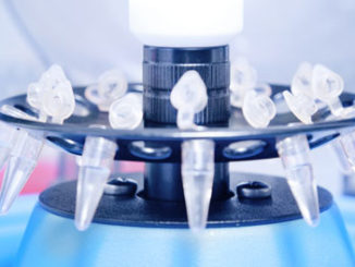A Starter Chromatin Immunoprecipitation (ChIP) Protocol