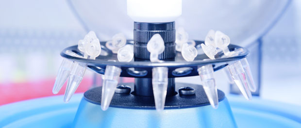 technical-chip-part-2 A Starter Chromatin Immunoprecipitation (ChIP) Protocol