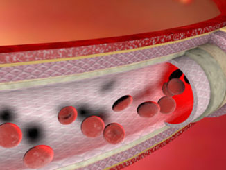 Histone Demethylation Plays a Role in Turning Stem Cells into Blood Vessel Cells