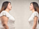 Epigenetics Could Turn on ‘Obesity Switch’