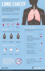 ihc-lung-cancer