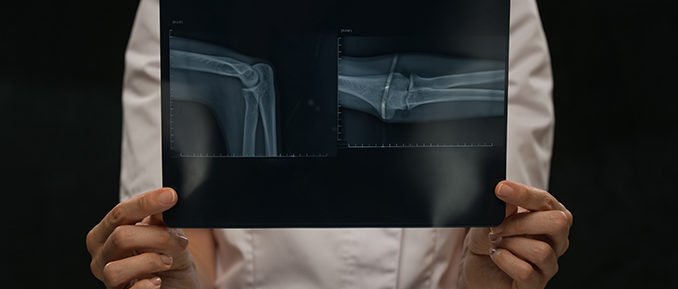 bone-image