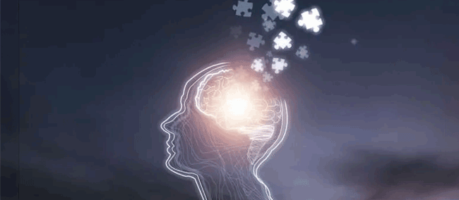 Alzheimers-Brain